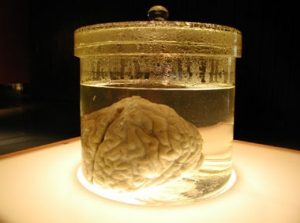 アインシュタインの脳_history.monovtube.com